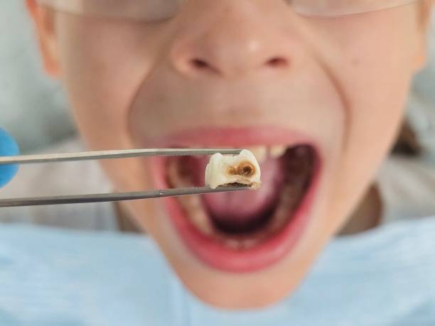 Best Emergency Orthodontic Repairs in Falling Waters, WV