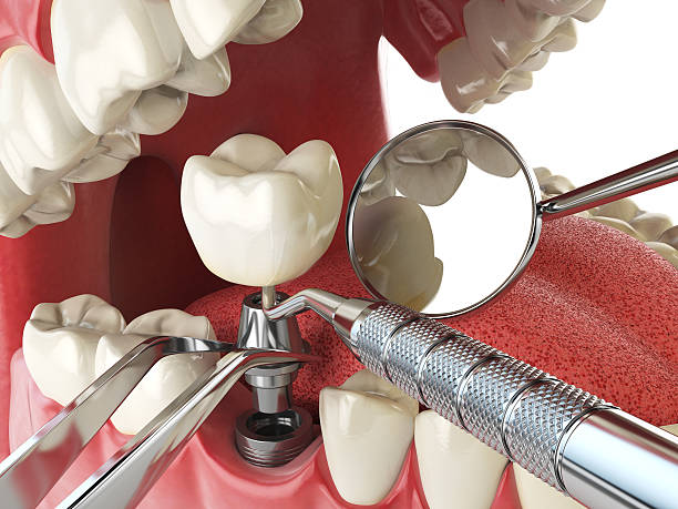 Best Emergency Dental Surgery in Falling Waters, WV